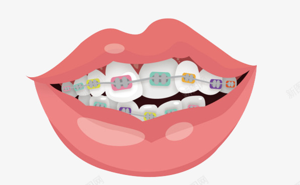 牙齿嘴唇牙套卡通png免抠素材_88icon https://88icon.com 牙齿 嘴唇 牙套 卡通