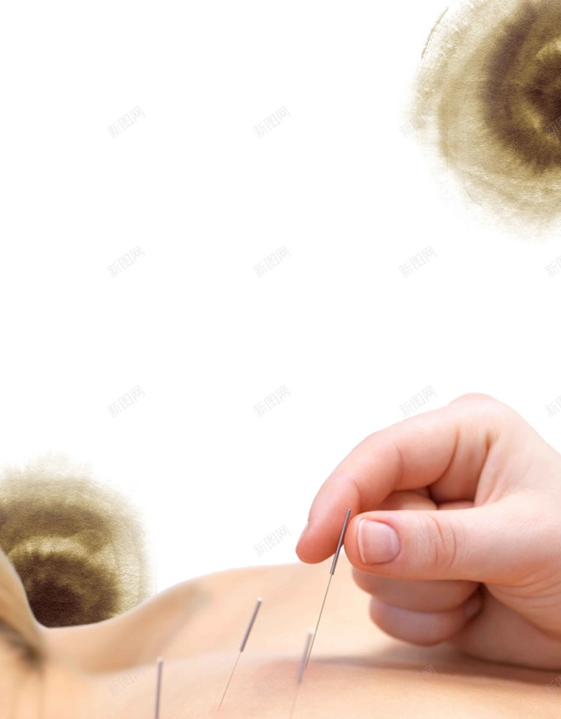 传统中医针灸中国风简约背景jpg设计背景_88icon https://88icon.com 中国风 传统中医 医学 医学背景图片 复古 治疗 简约 背景 针灸