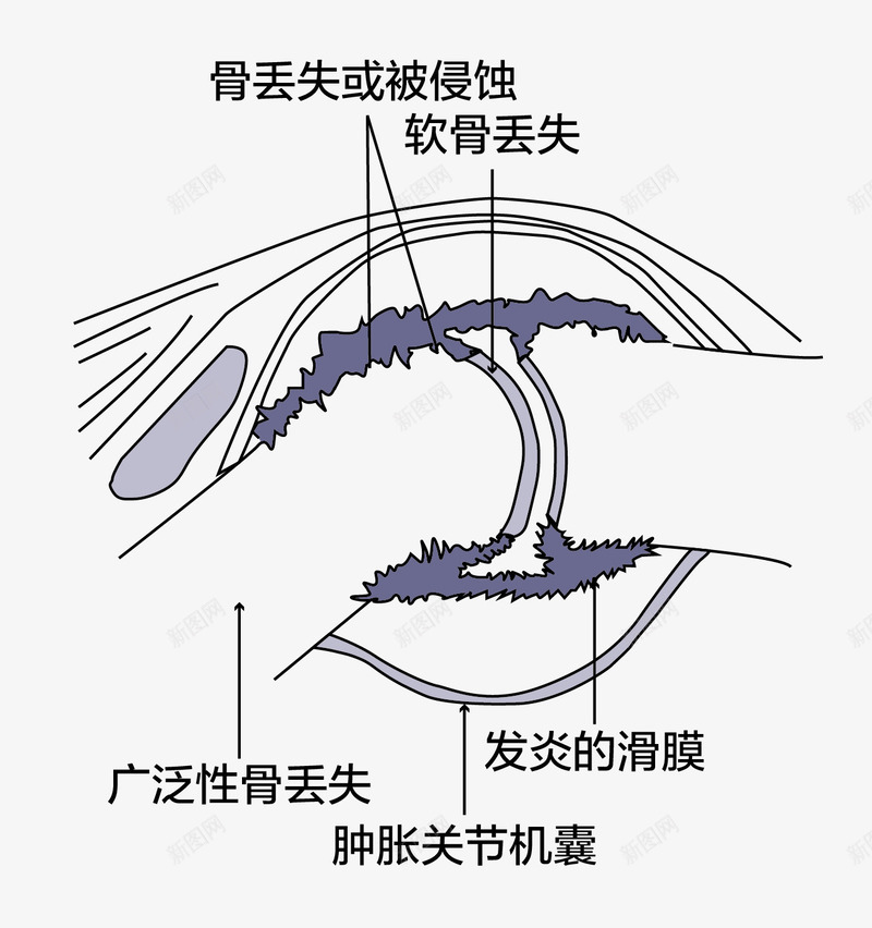 人体骨关节效果图png免抠素材_88icon https://88icon.com 人体关节 免抠图 效果图 文字 装饰画 骨关节