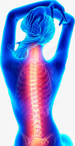 防疾病女性的背部脊椎图高清图片