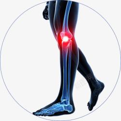 疼痛膝盖骨关节手绘图高清图片