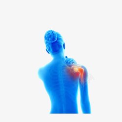 肩膀立体肩膀痛的X光下的女士高清图片