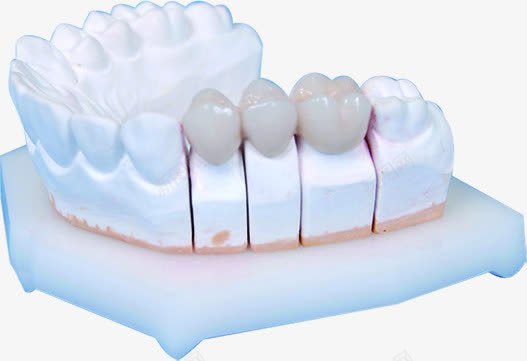 假牙主题牙科展板png免抠素材_88icon https://88icon.com 主题 假牙 展板 牙科