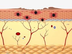皮肤组织图皮肤排毒问题高清图片