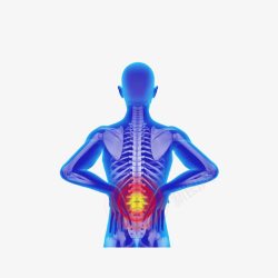 一肩荔枝图手绘腰椎疼痛X光人体图高清图片