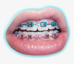 彩色迷幻彩色牙套的嘴高清图片