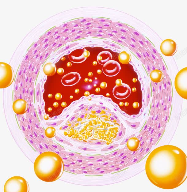 血脂细胞png免抠素材_88icon https://88icon.com 胆固醇 脂肪 血管 血脂细胞