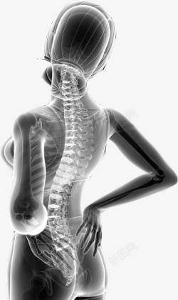 防疾病女性的背部脊椎图高清图片