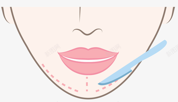 尖下巴手术整形图标图标