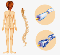 人体脊柱脊椎矢量图素材