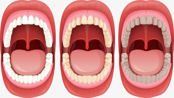 口腔牙齿健康问题矢量图ai免抠素材_88icon https://88icon.com 口腔 口腔健康 牙齿 牙齿健康 牙齿变黄 矢量png 矢量图
