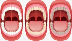 口腔牙齿健康问题矢量图素材