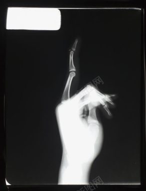 伸出一根手指的手部x光图像背景