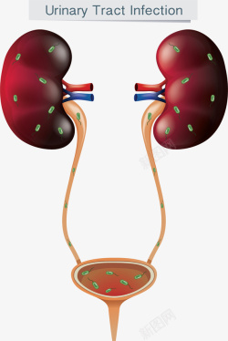 发炎医学尿路感染示意图高清图片