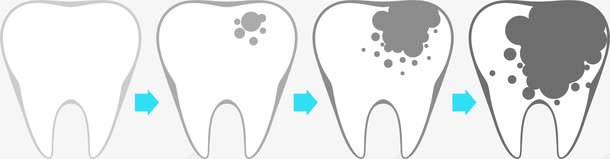 icon地址龋齿演变图标图标