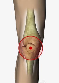 腿肘部上的红点素材