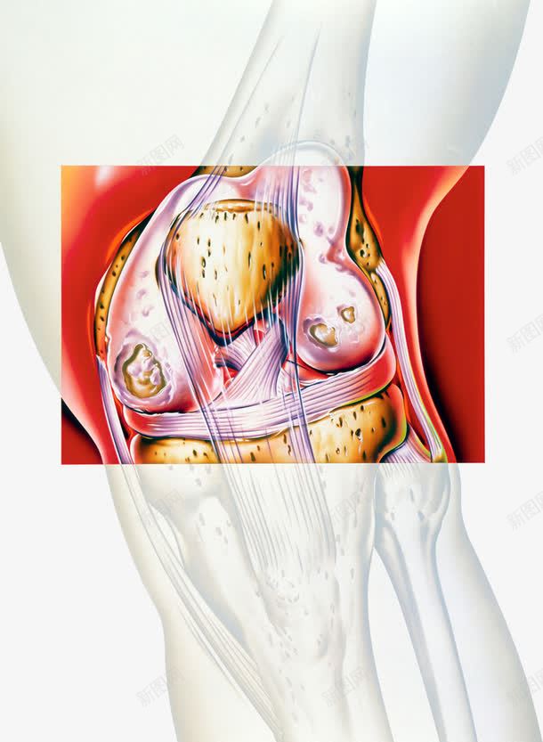 膝关节结构彩图png免抠素材_88icon https://88icon.com 关节炎 细节图 肌肉 软骨结构