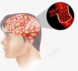 大脑血管人类大脑血管分析图矢量图高清图片