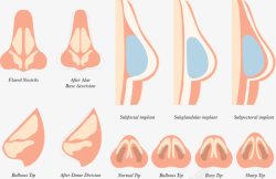 面部五官不同角度鼻子高清图片
