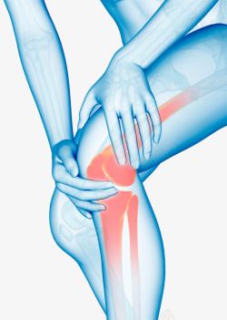 X光透视图膝盖骨折高清图片
