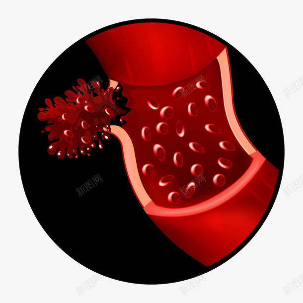 医疗红色细胞壁矢量图ai免抠素材_88icon https://88icon.com 卡通 心脑血管 病毒 细胞体 脑出血 血管 血管壁 矢量图