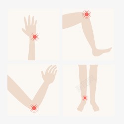 四肢疼痛标示图四肢疼痛示意图高清图片