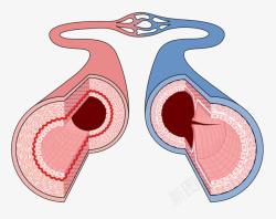 动静脉动静脉血管高清图片
