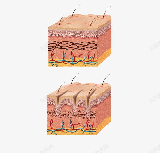 皮肤层png免抠素材_88icon https://88icon.com 护肤 松弛 毛孔收缩 皮肤组织图 皮肤表皮 紧致皮肤