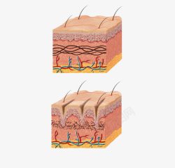 皮肤层结构皮肤层高清图片