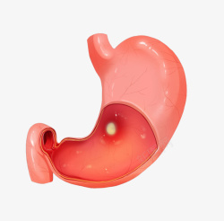 胃器官疾病卡通插画素材