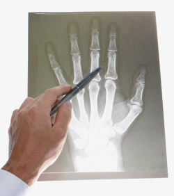 手指X光片素材
