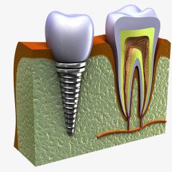 解剖图牙痛修复解剖图高清图片