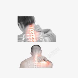 颈肩乐颈椎颈椎疼的男女实物图高清图片