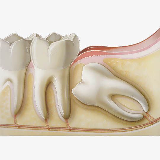 卡通立体牙齿和智齿图示png免抠素材_88icon https://88icon.com 卡通 图示 拔牙 插图 智齿 牙神经 牙科 牙齿 牙齿修护卡通图 牙龈 牙龈健康刷牙防蛀牙 立体