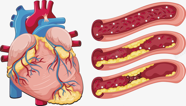 心脏血管矢量图eps免抠素材_88icon https://88icon.com 人体心脏 心脏 心脏图案 心脏血管 矢量图 血管PNG 血管心脏