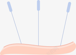 皮肤卡通针灸素材