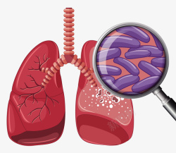 肺病与病菌矢量图素材