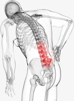 防疾病男性的背部脊椎图高清图片
