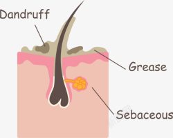 头皮堵塞粉色卡通发囊高清图片
