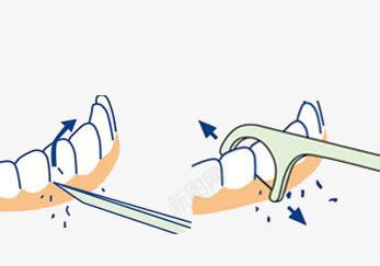 正确剔牙牙线清洁牙齿指示图png免抠素材_88icon https://88icon.com 指示 正确 清洁 牙齿