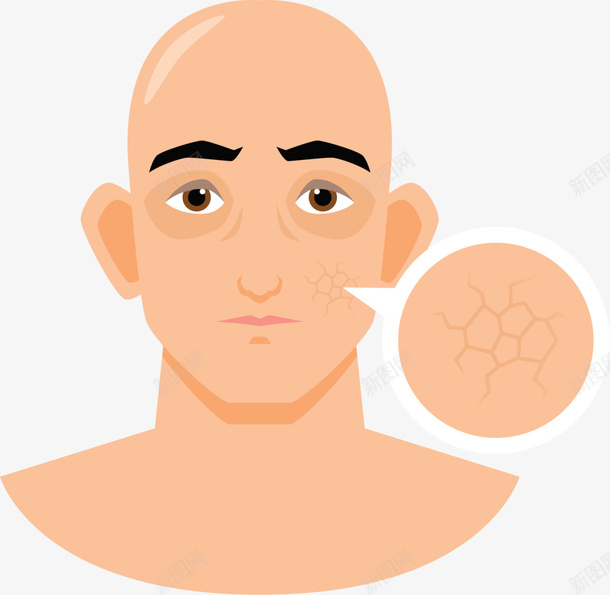 皮肤干裂卡通男人png免抠素材_88icon https://88icon.com SPA 卡通男人 护肤 皮肤去皱 皮肤干裂 皮肤表皮 美丽 美妆 美容院