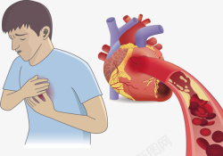 血管图案心脏血管堵塞矢量图高清图片