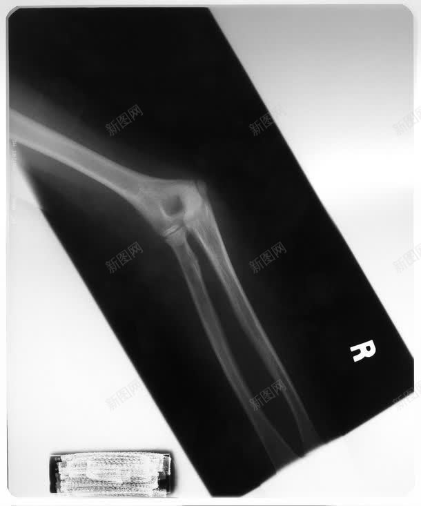 X光片特写jpg设计背景_88icon https://88icon.com CT X光片 X光片特写高清图片 X光片特写高清图片素材下载 关节 其它类别 医学 医学背景图片 图片素材 疗 背景花边 脚 踝骨 骨骼