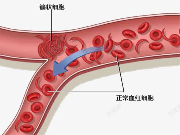 血红细胞示意图png免抠素材_88icon https://88icon.com 医学细胞 图示 手绘 红细胞 红细胞血液插图 血红细胞