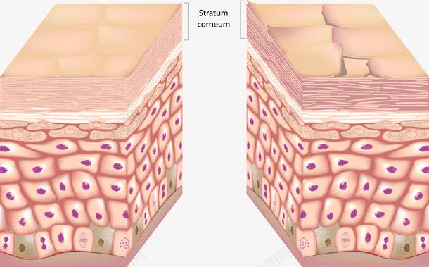 人体的皮肤png免抠素材_88icon https://88icon.com 剖面 皮肤 细胞