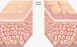 人体皮肤剖面人体的皮肤高清图片