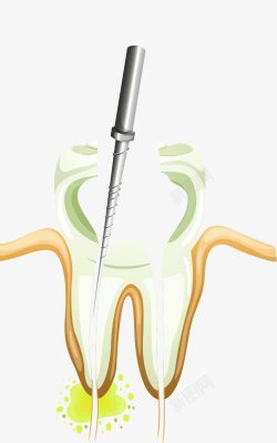 牙痛治疗卡通图素材