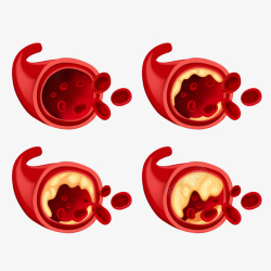 矢量红细胞医疗细胞体高清图片