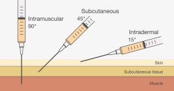 皮下注射皮内皮下机内注射矢量图高清图片