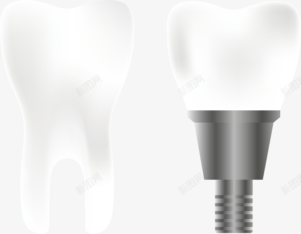 正常的牙齿和种植的牙齿矢量图eps免抠素材_88icon https://88icon.com 牙齿 牙齿png 牙齿矢量图 白牙 白色 矢量图
